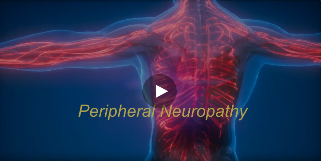 Peripheral Neuropathy at Maplewood Wellness in Coral Springs, FL